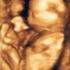 Unborn Boy