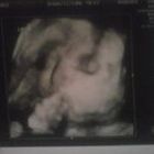 Crysta Lynn Gibson