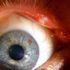 Cypher Sore Eyes