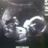 William Cedillo