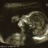 Maddox Shane