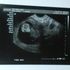 RHINO SUFFLE