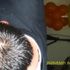 TONY MURILLO