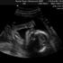 Lily Tucker Bray