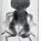 Lorenzo Man
