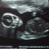 JUn lIsangelee Feliciano Millan