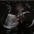 Christopher Lilred Quarles