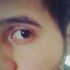 Alanin L